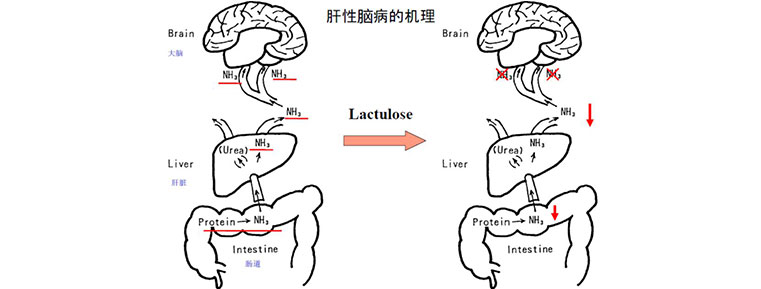 lactulose-advantages5.jpg